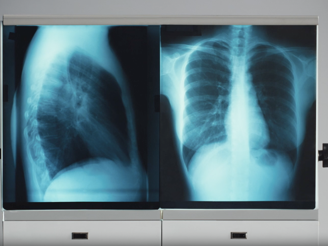 image of an x-ray