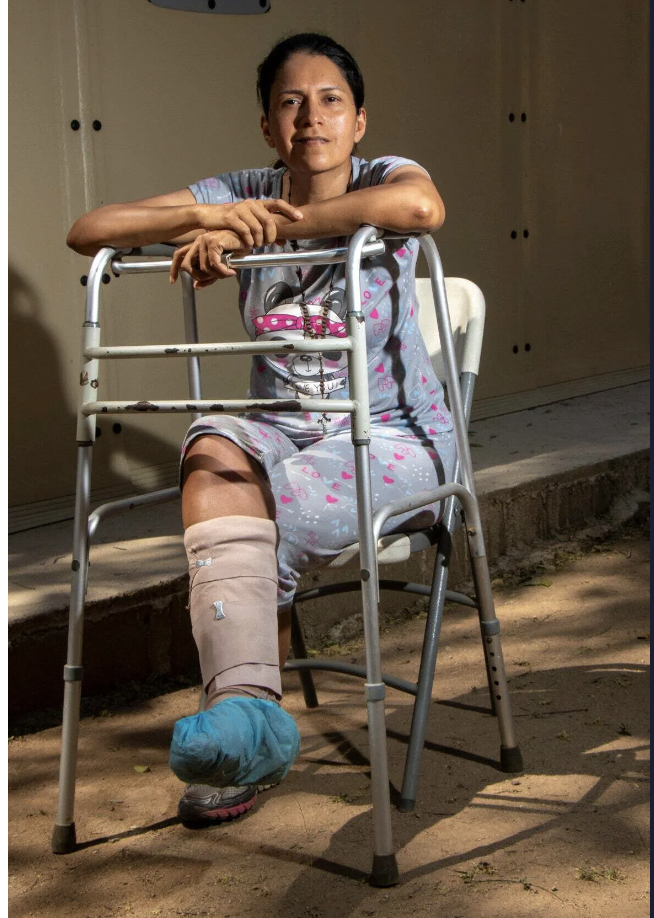 A woman with a bandaged leg facing the camera