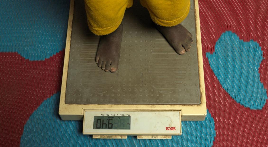 A young child is screened for malnutrition in South Sudan after crossing the border.